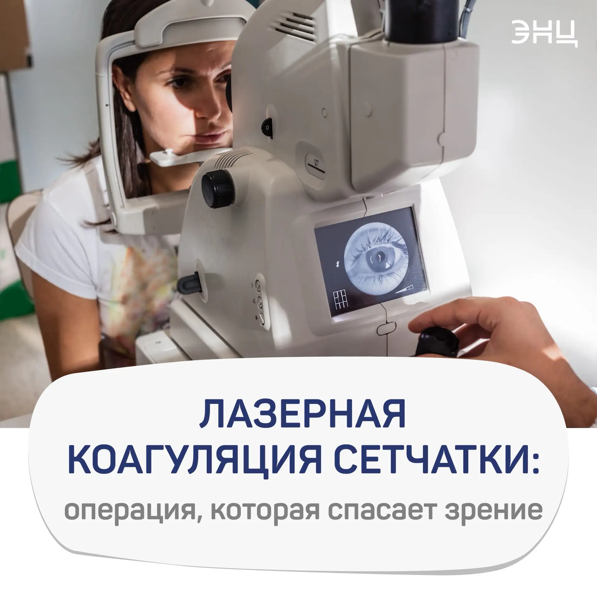 Лазерная коагуляция сетчатки: операция, которая спасает зрение
 
👁️ Высокий уровень глюкозы годами 