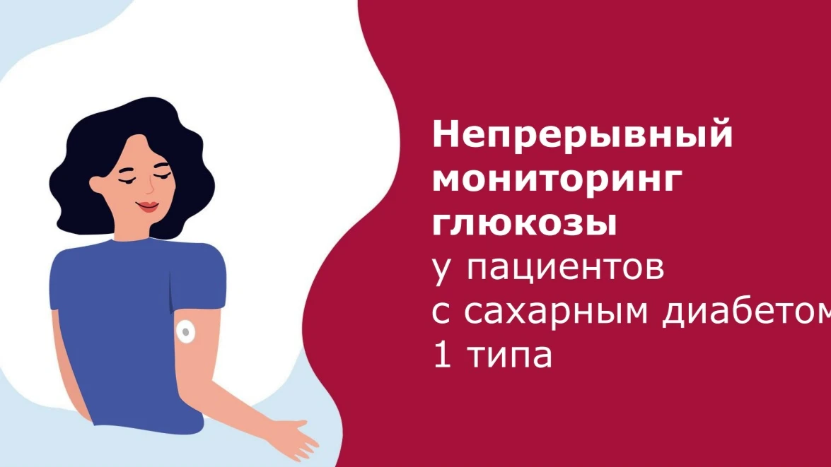 Непрерывный мониторинг глюкозы шаг к более осознанному контролю здоровья