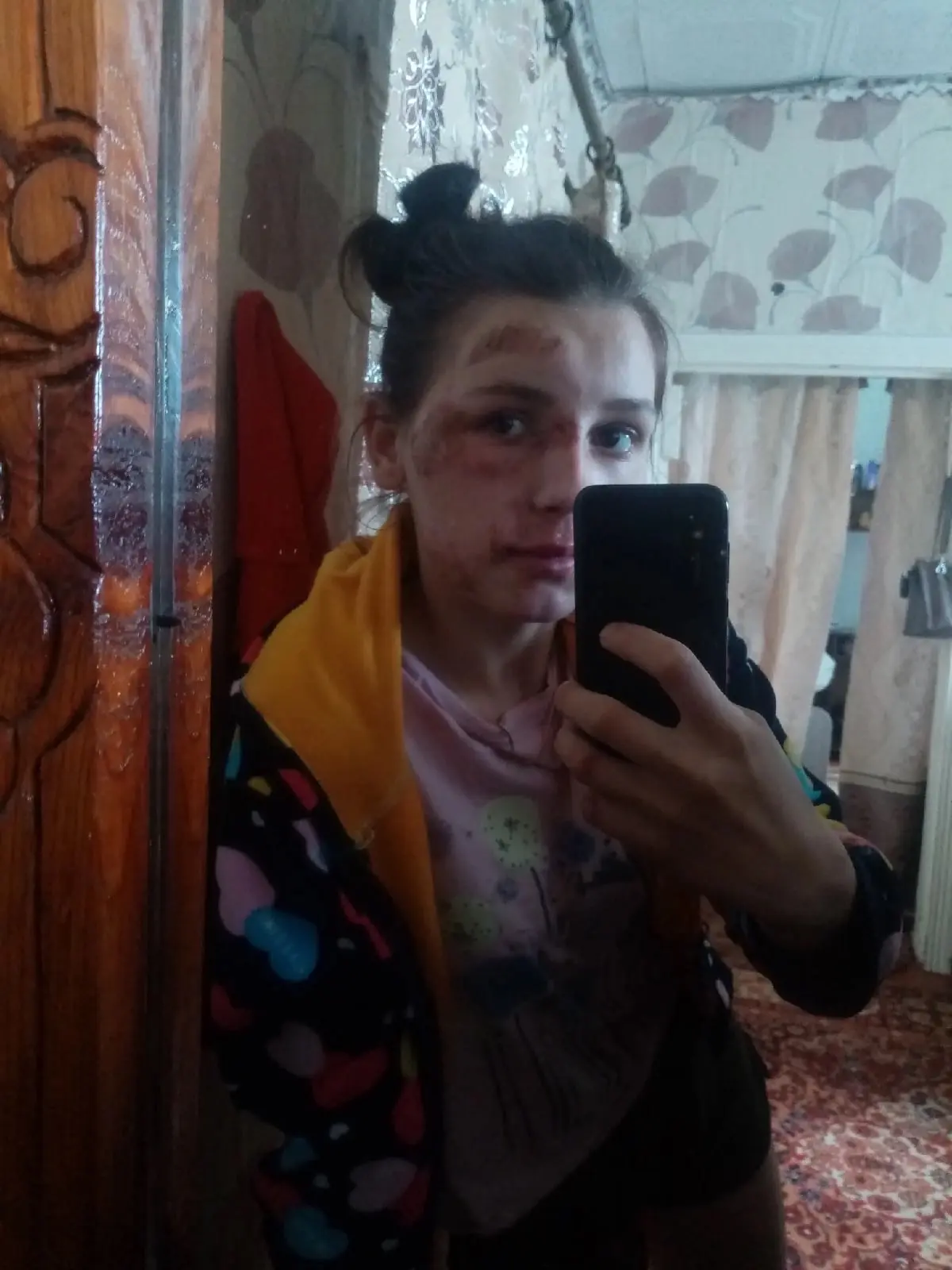 Когда-то, в далёком 2021 году, я упала с мотоцикла, причём ехала всего на первой скорос...
