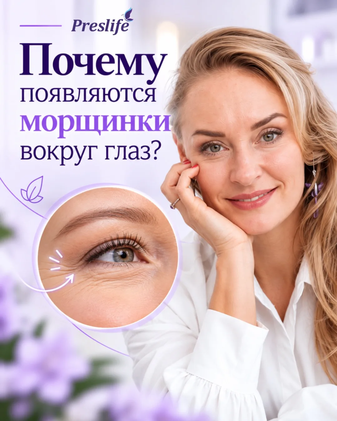 «Гусиные лапки»: почему появляются морщинки вокруг глаз?