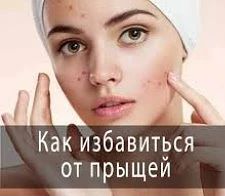 КАК ИЗБАВИТЬСЯ ОТ ПРЫЩЕЙ?