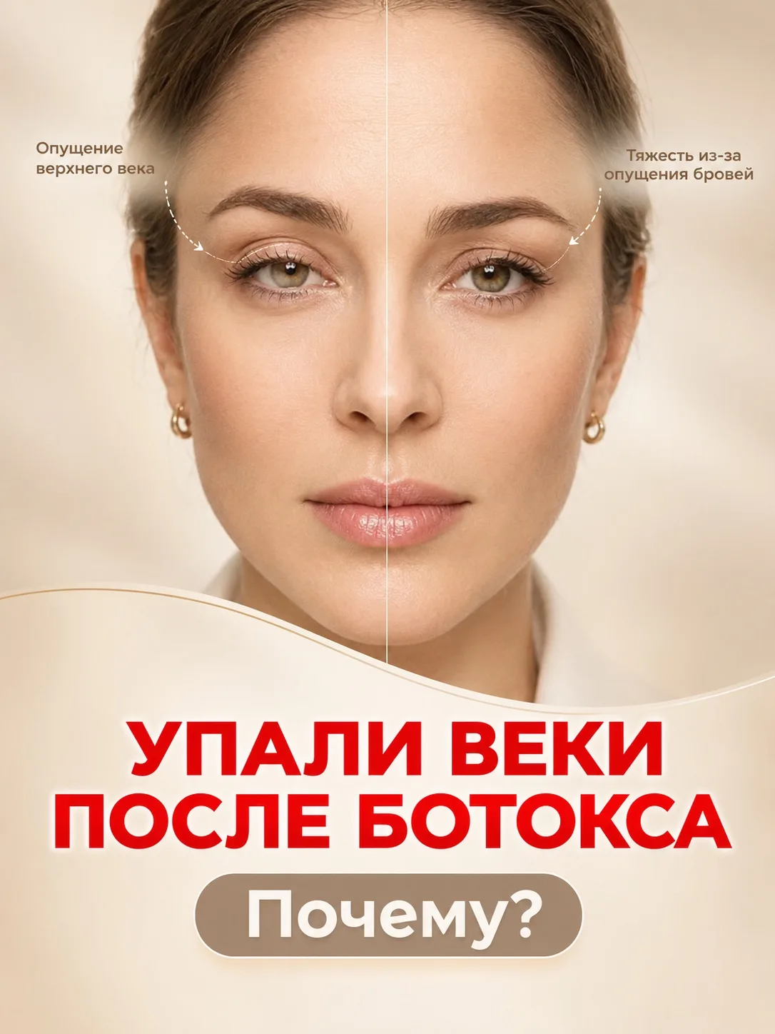 УПАЛИ ВЕКИ ПОСЛЕ БОТОКСА?