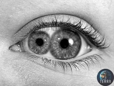 👀 Перед вами Pupula duplex (это двойной зрачок).