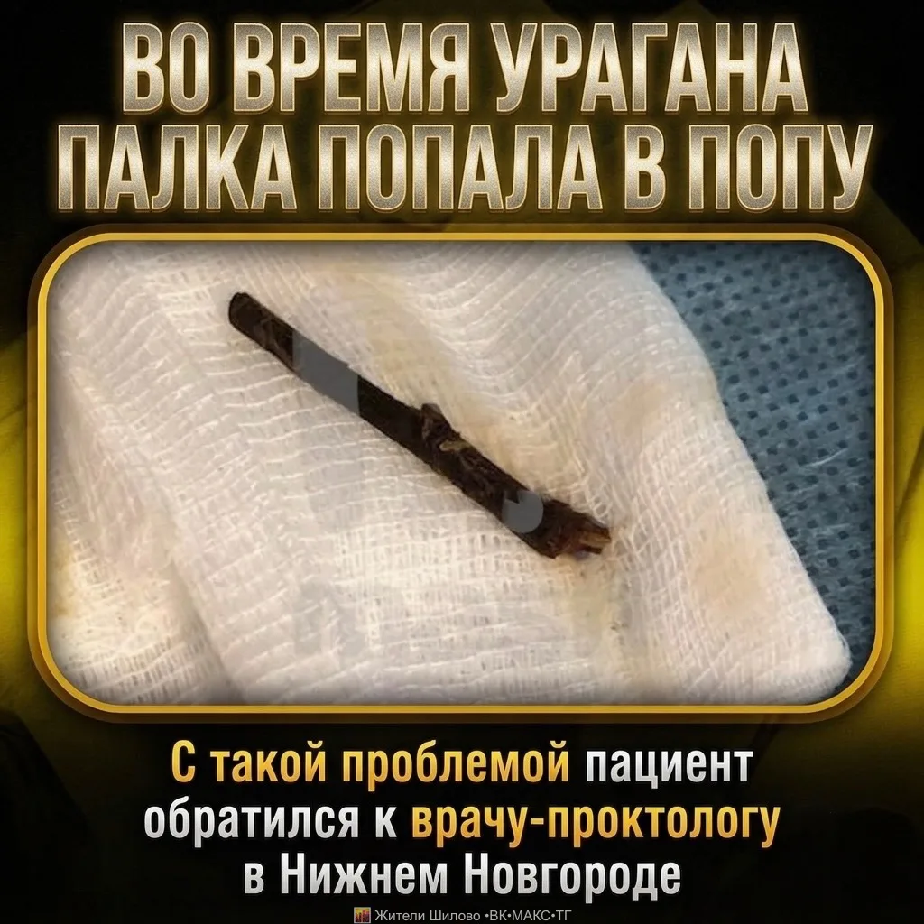 🤯 ПАЛКА В 👉 🍑 

На приеме у врача мужчина поведал историю, как он гулял по лесу во время урагана,