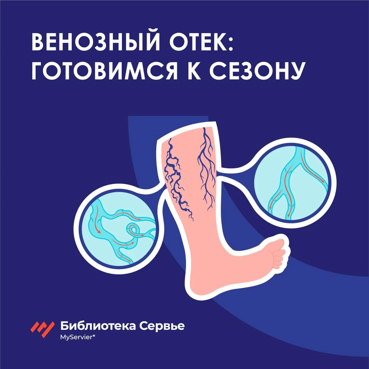 Лето — сезон венозных отеков. Готовимся к росту числа пациентов с ХЗВ