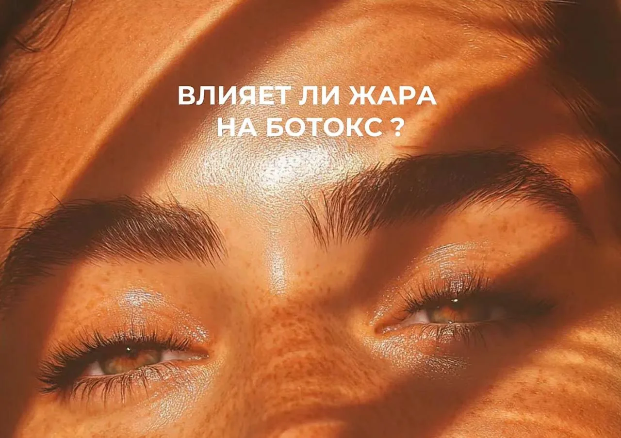 Влияет ли летняя жара на ботулинотерапию? ☀️