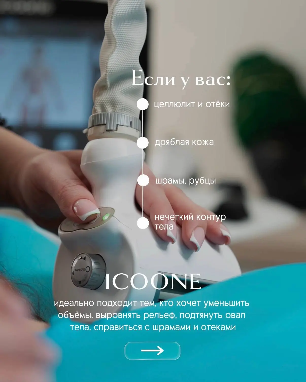 ICOONE Laser — инновация в мире лифтинга, моделировании фигуры и омоложения. 🔝