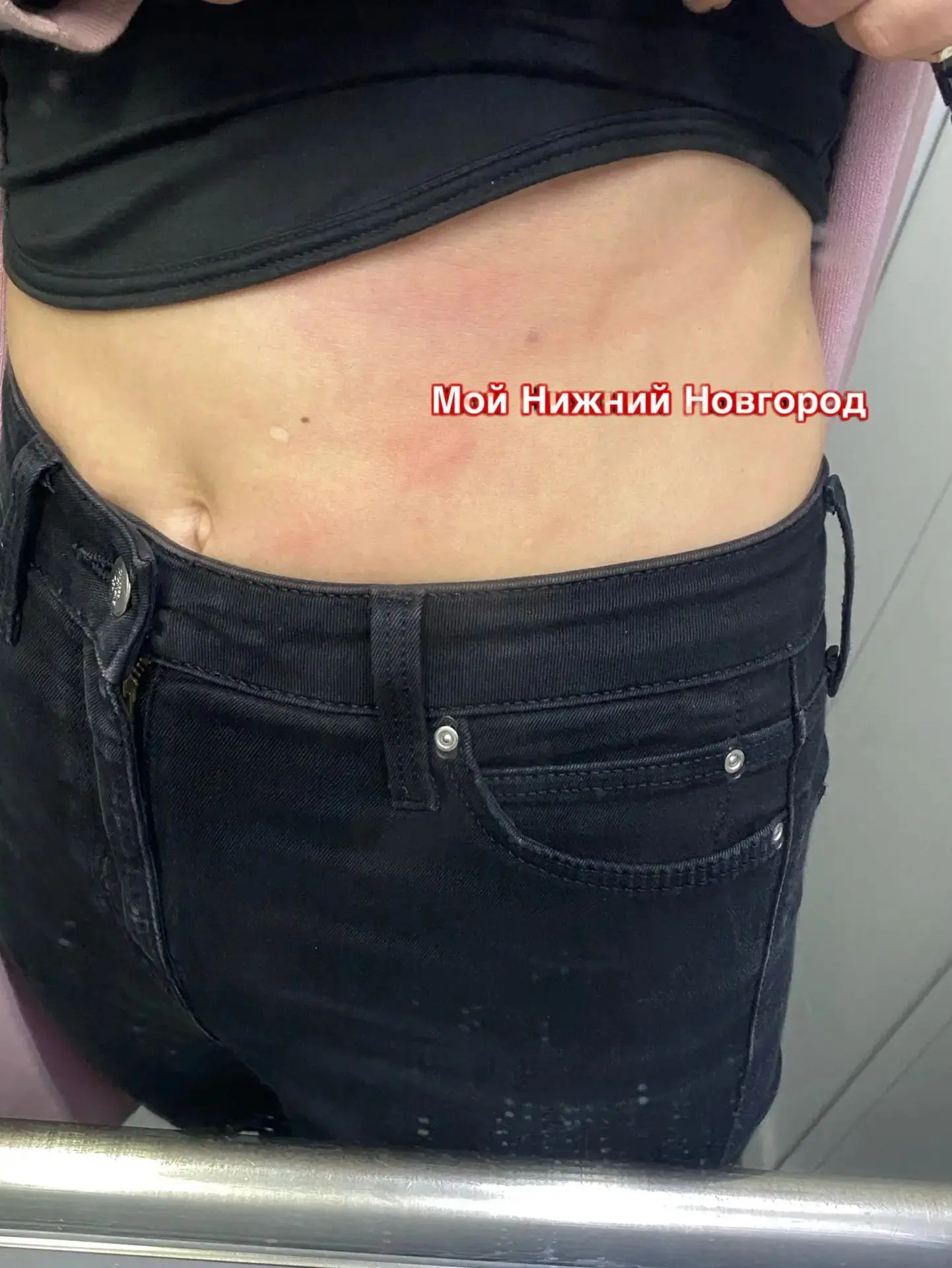 ❗Доберман искусал девушку в ЖК «Седьмое небо»