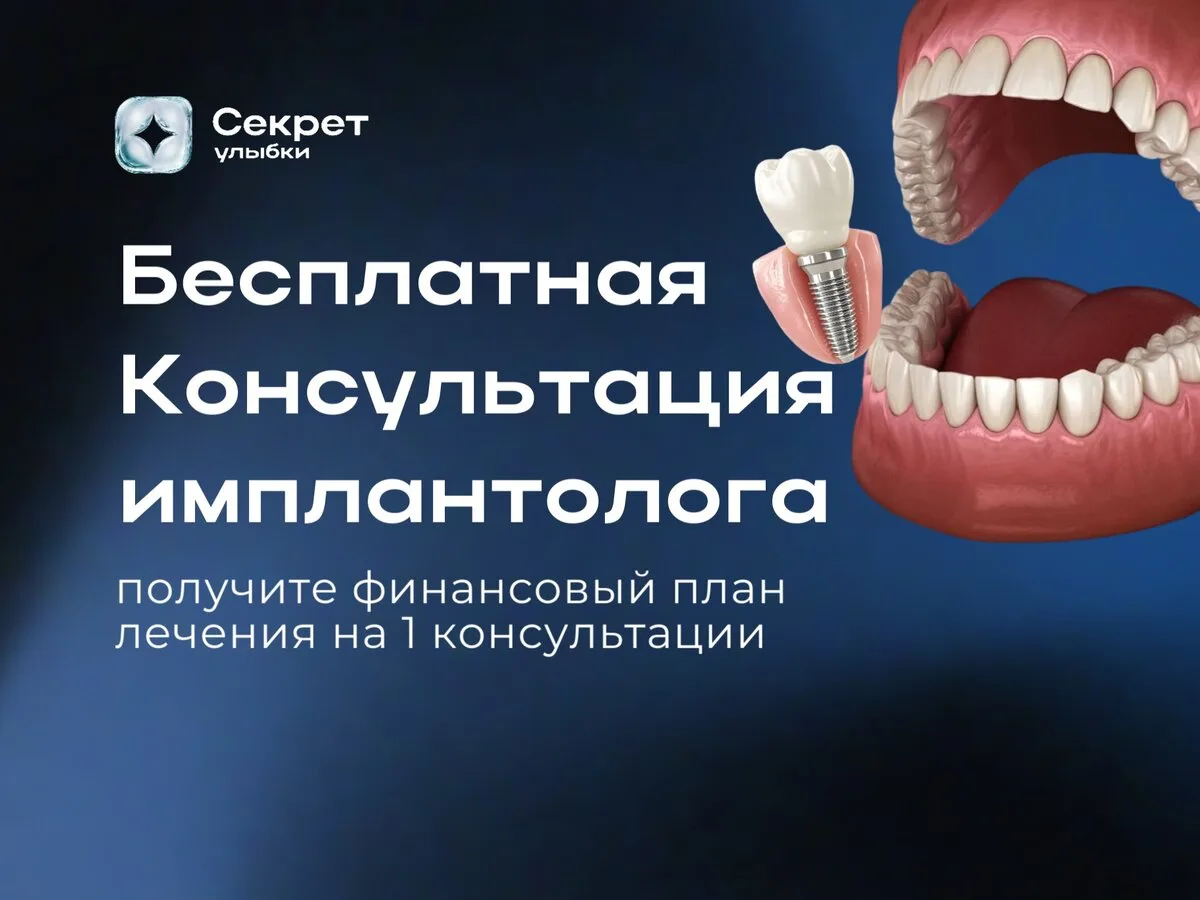 До 31 августа консультация по имплантации - 0 ₽