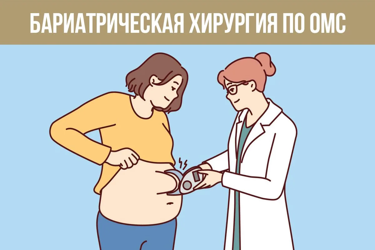 Бариатрические операции при тяжёлом ожирении стали доступнее