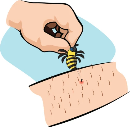 🐝 Первая помощь при укусах насекомых: памятка для родителей

🍓Лето — время прогулок, дач и поездок