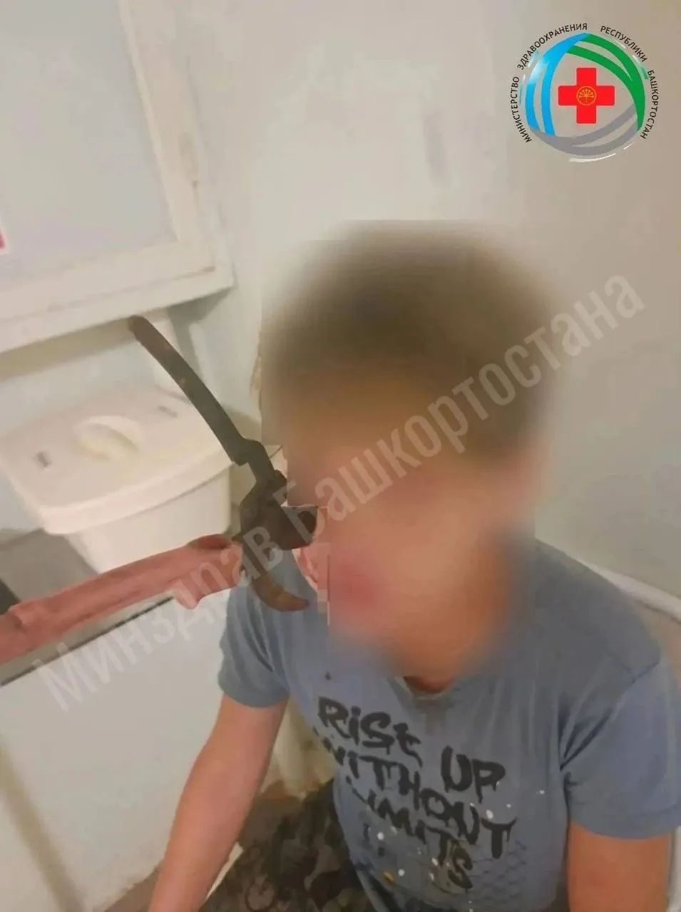 🧑‍⚕️ В Дюртюлинской ЦРБ прооперировали подростка с секатором в лице

В приемное отделение Дюртюлинс