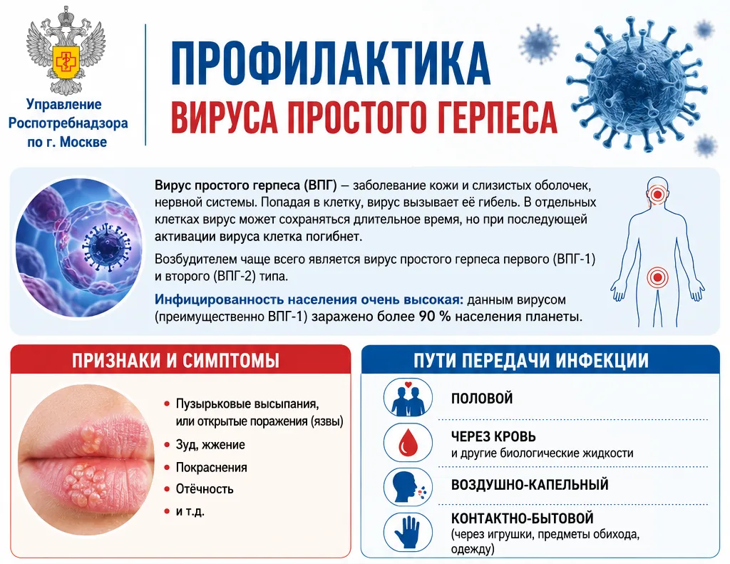 Профилактика вируса простого герпеса  Вирус простого герпеса (ВПГ) – заболевание кожи и слизистых об