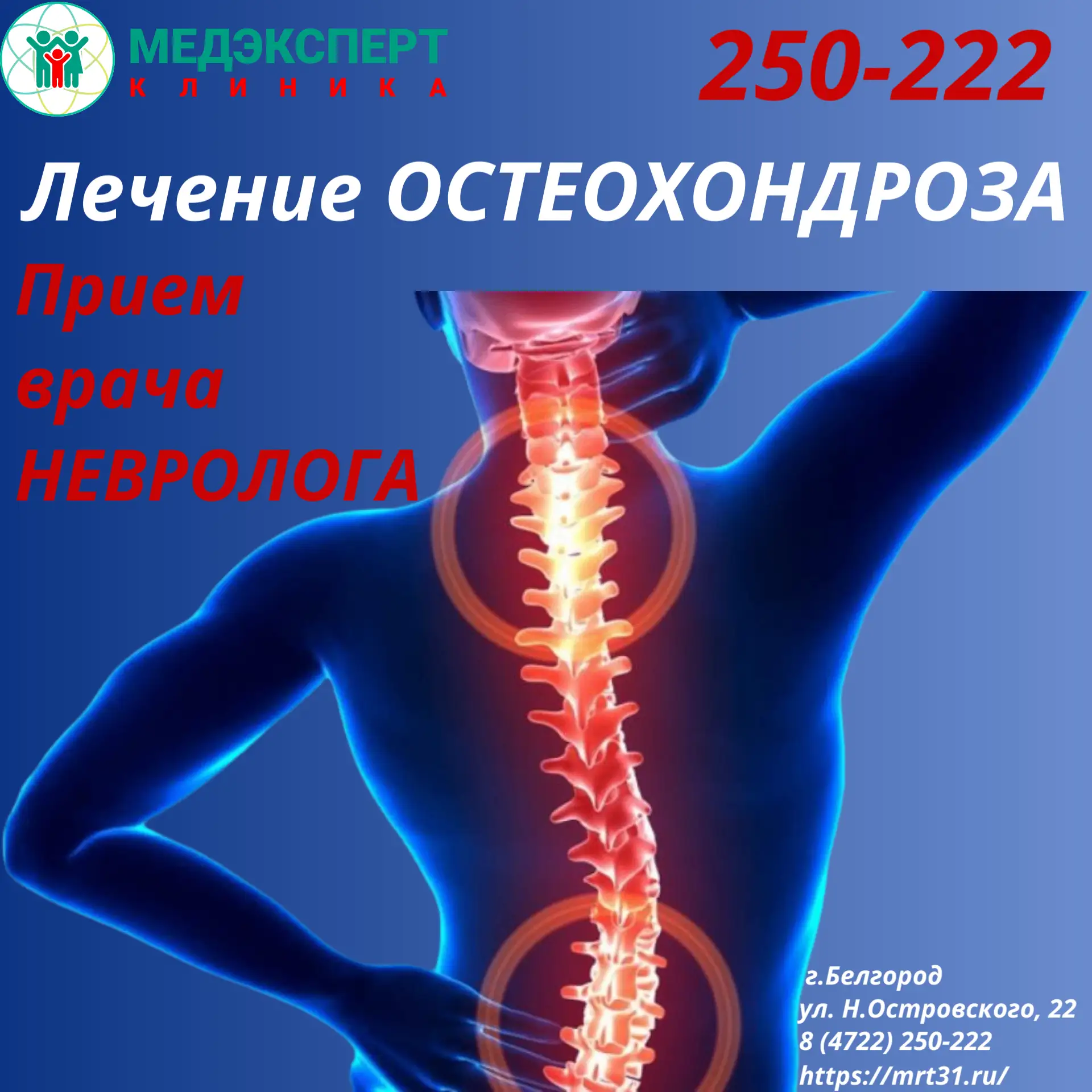 Остеохондроз — это хроническое дегенеративно-дистрофическое заболевание, при котором ис...