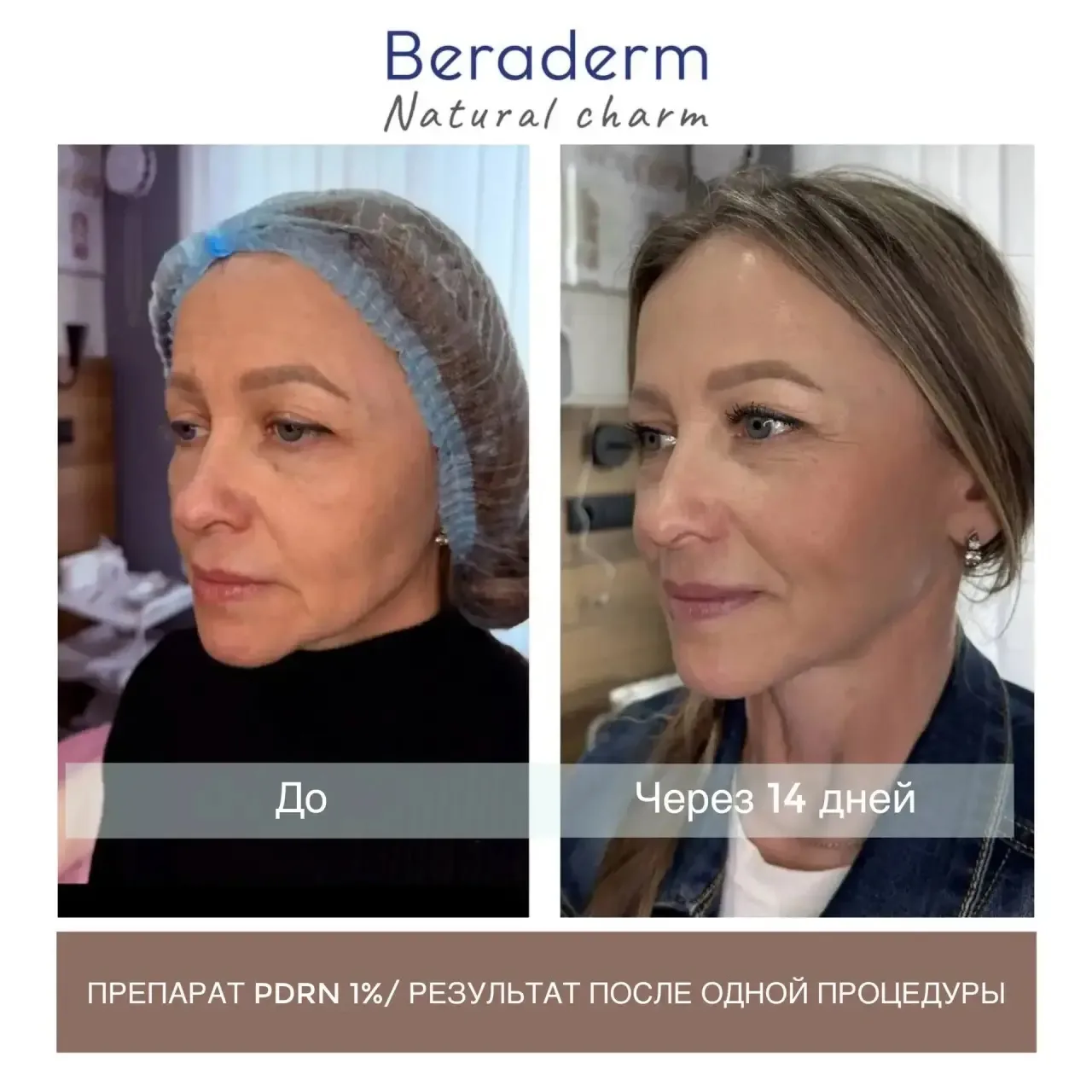🧬 PDRN, который работает не только на увлажнение