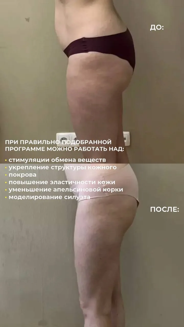 Аппаратный массаж — это не просто «полежать на аппарате» 👇🏻