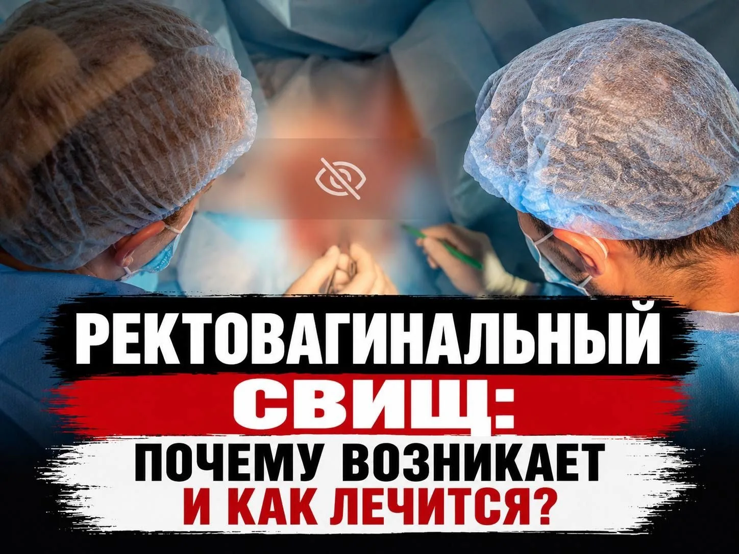 🔄 Ректовагинальный свищ: почему возникает и как лечится?