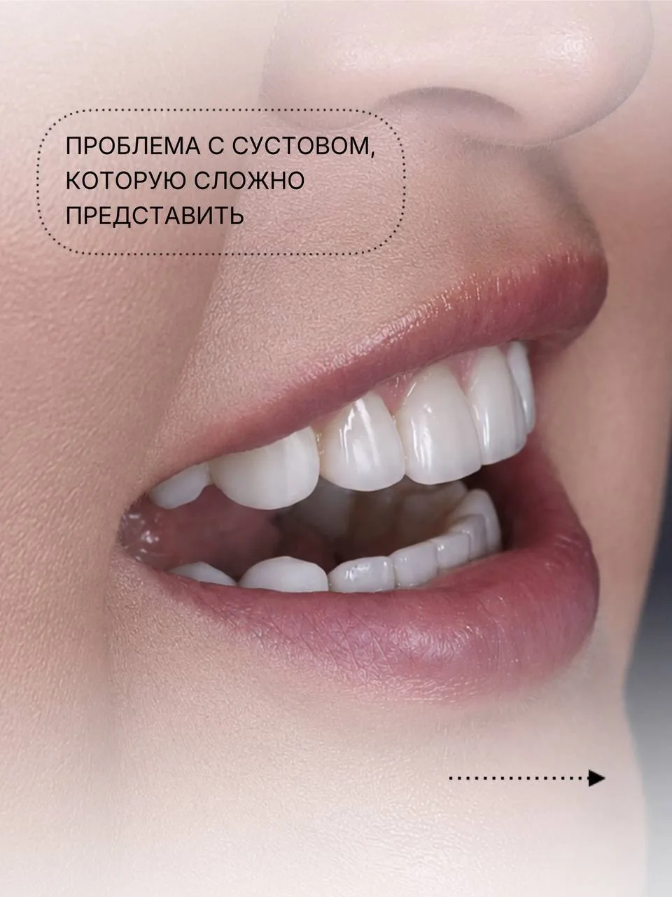 Проблема с суставом, которую сложно представить
