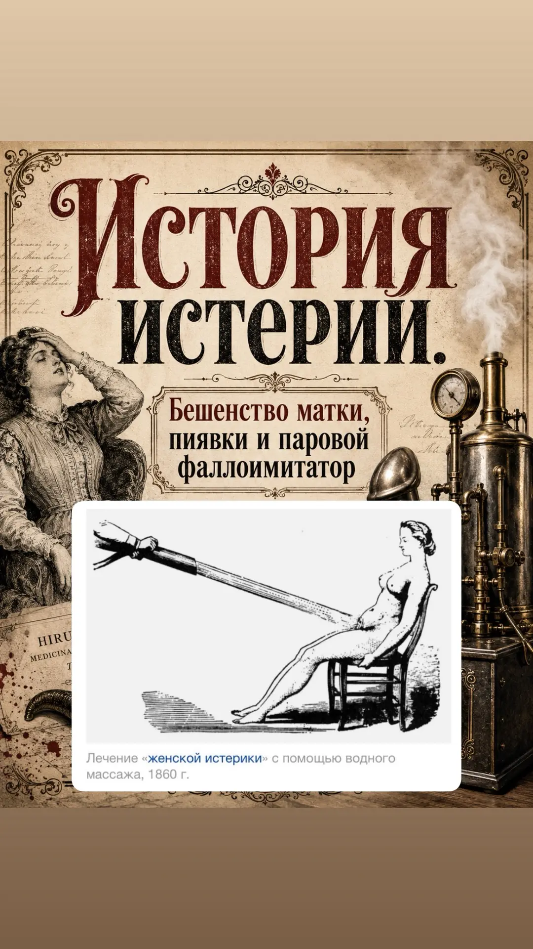 История истерии.Бешенство матки, пиявки и паровой фаллоимитатор

Термин Истерия происходит от древне