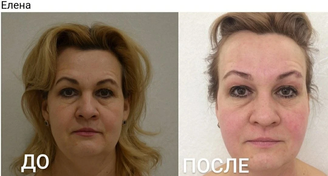 ОТЛИЧНЫЕ РЕЗУЛЬТАТЫ! 🤩

Сегодня хочу похвастаться шикарными результатами моей ученицы Елены. 
Она з