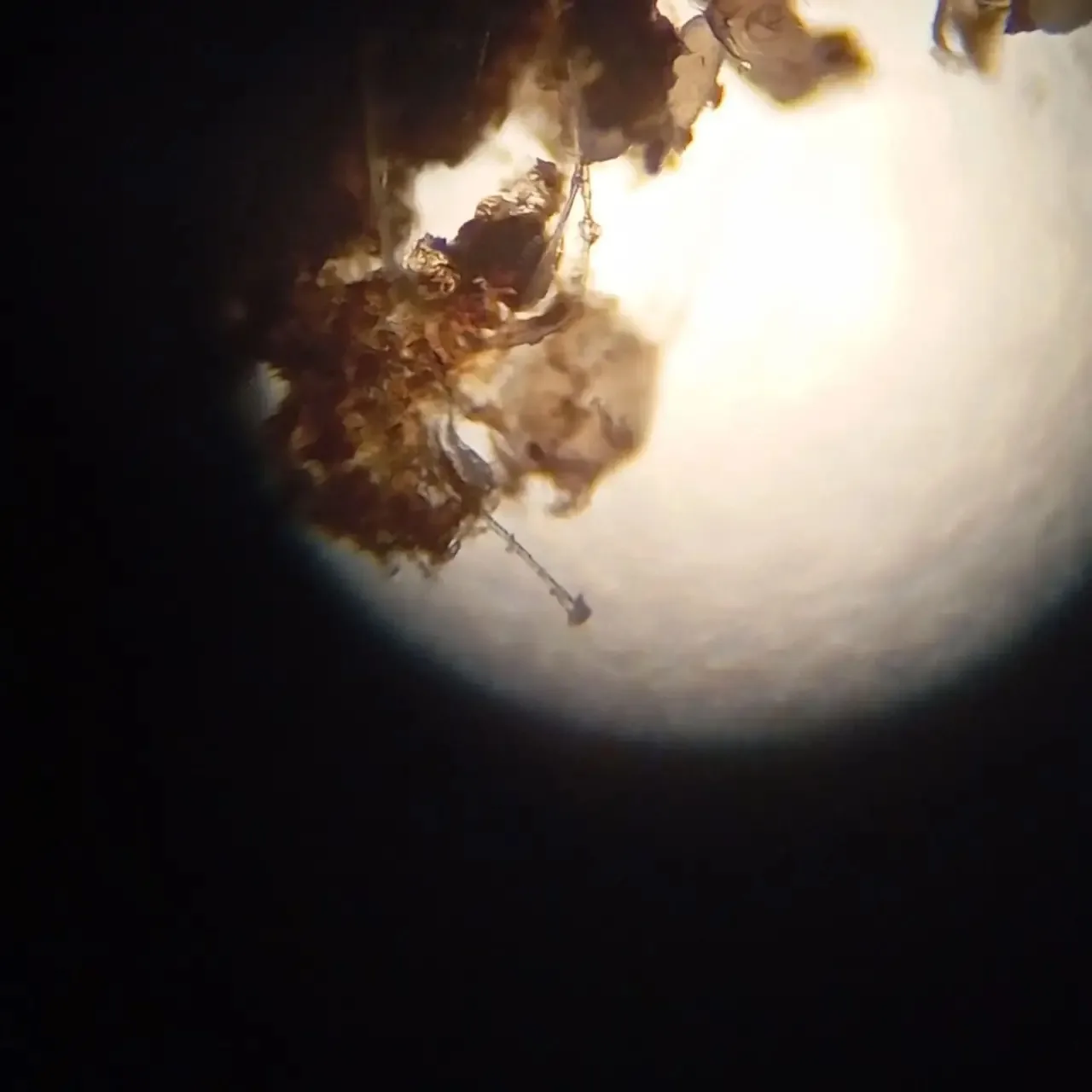 Когда в ушах не просто грязь 👂🔬