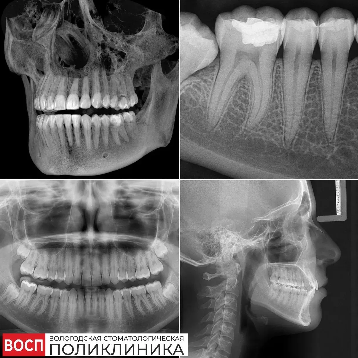 С начала года в Вологодской областной стоматологической поликлинике проведено уже более 15 000 рентг