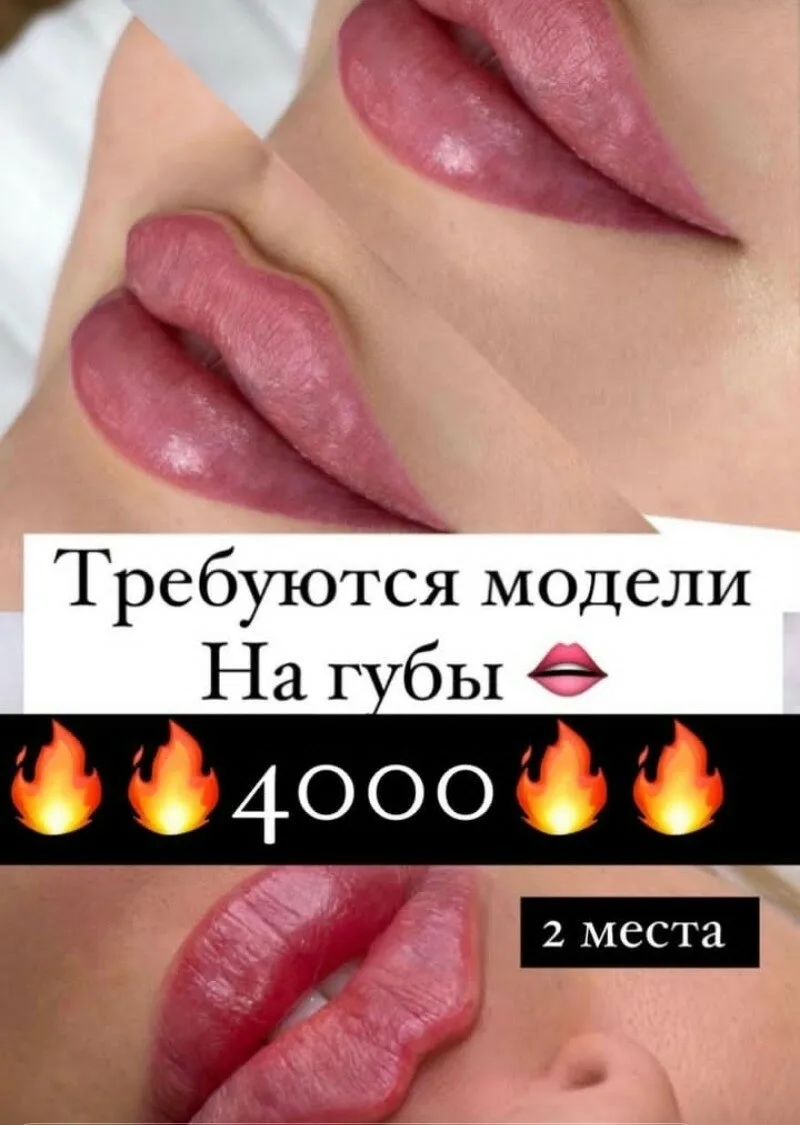 💋 Приглашаю моделей на увеличение губ!