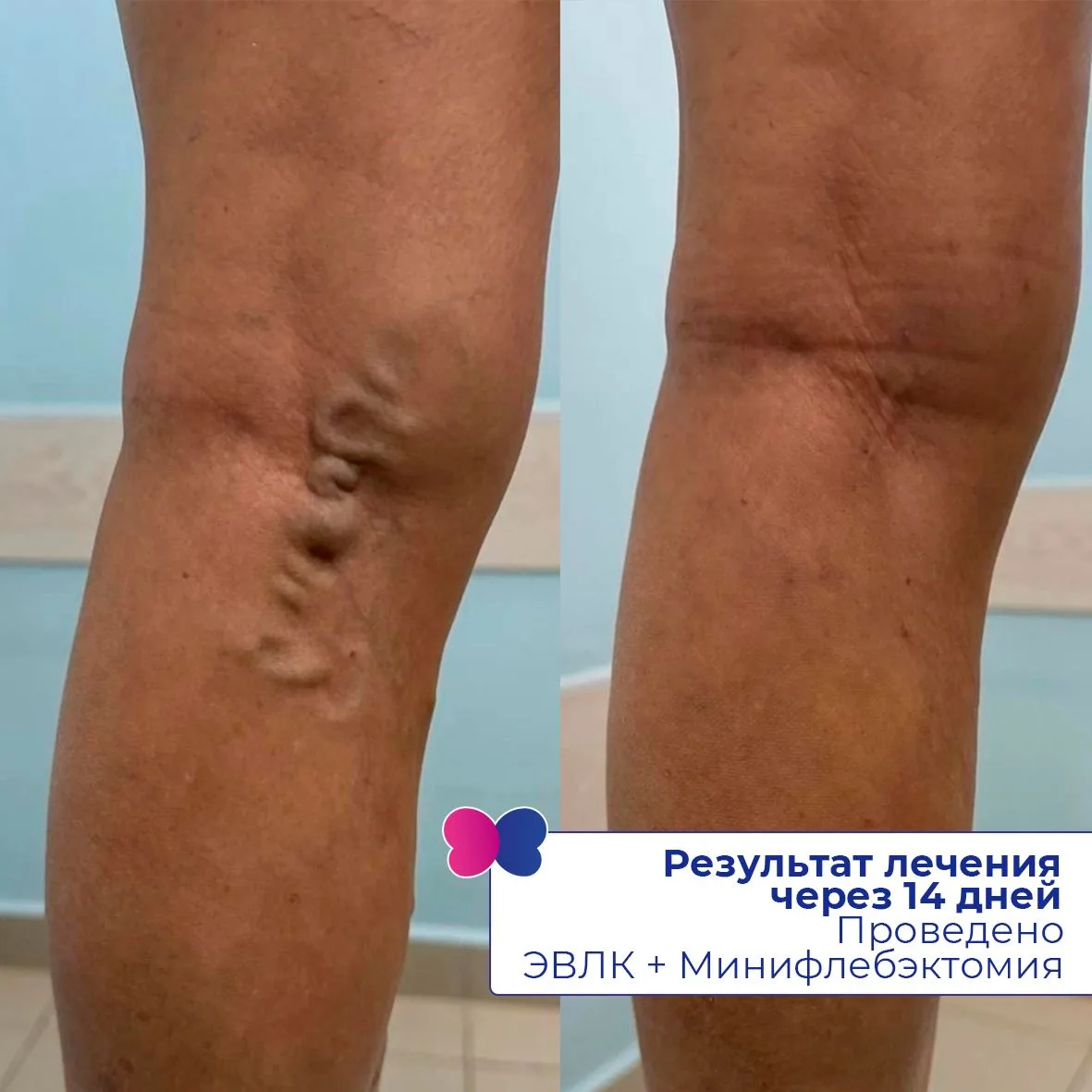 Ваше здоровье