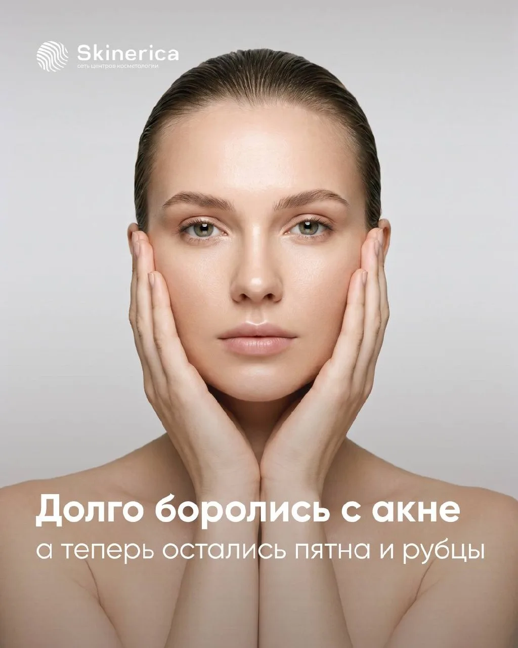 Воспалений почти нет, а в зеркале — пятна, неровный рельеф, расширенные поры. Кажется, ...