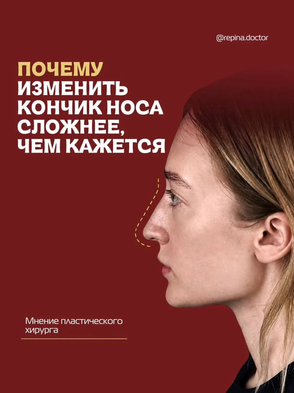 Почему изменить кончик носа сложнее, чем кажется? 🤔

Многие думают, что ринопластика – это просто у