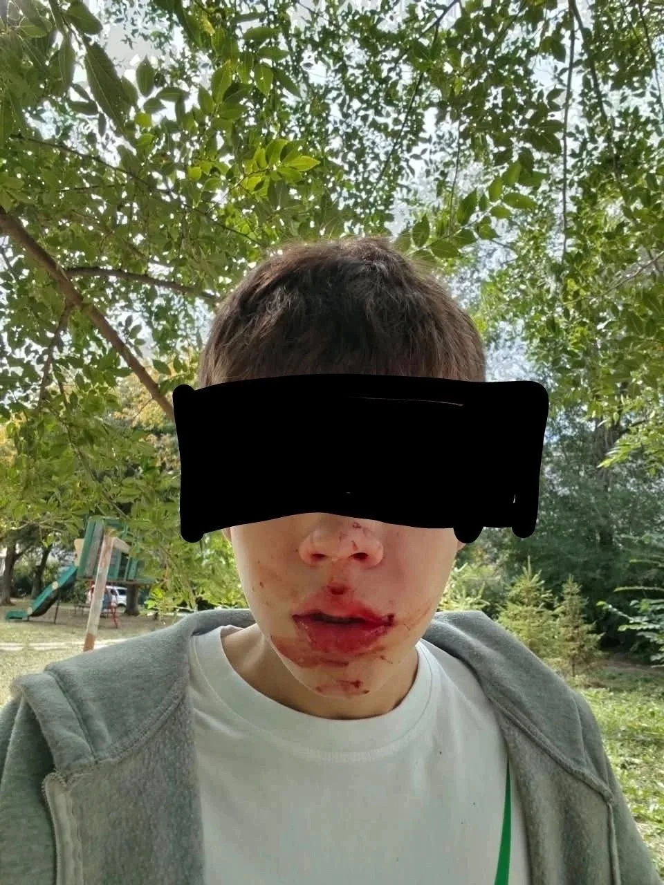 😰 В День знаний школьника из Магнитогорска избили одноклассники