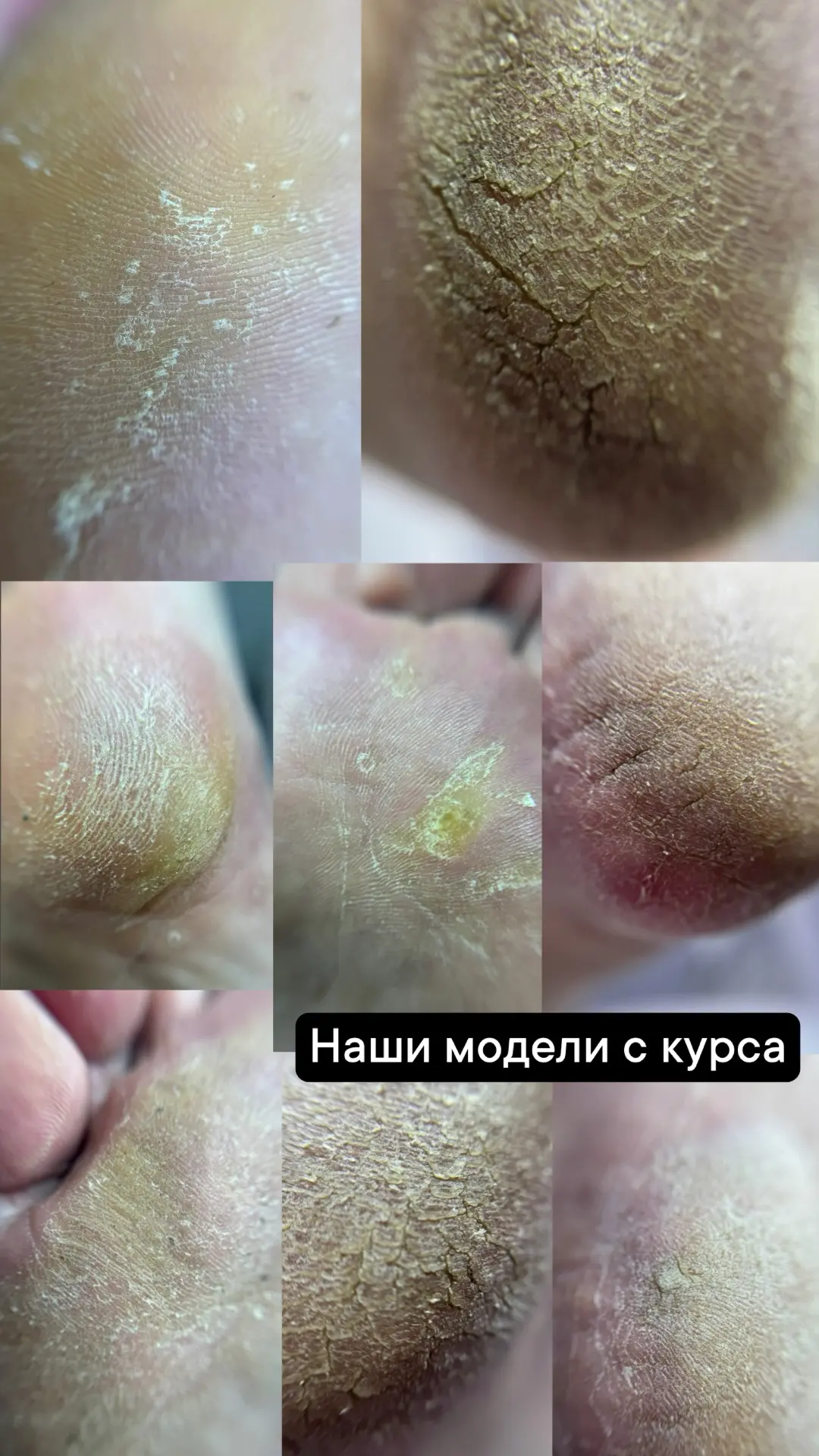 Наши модели с курса! Я учу думать ,а не просто клеить нити! Мы работаем на качество, а ...