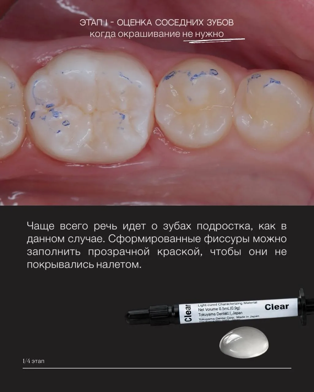 ✨Собрал пост про красители в моей работе: как делал раньше, как делаю сейчас.