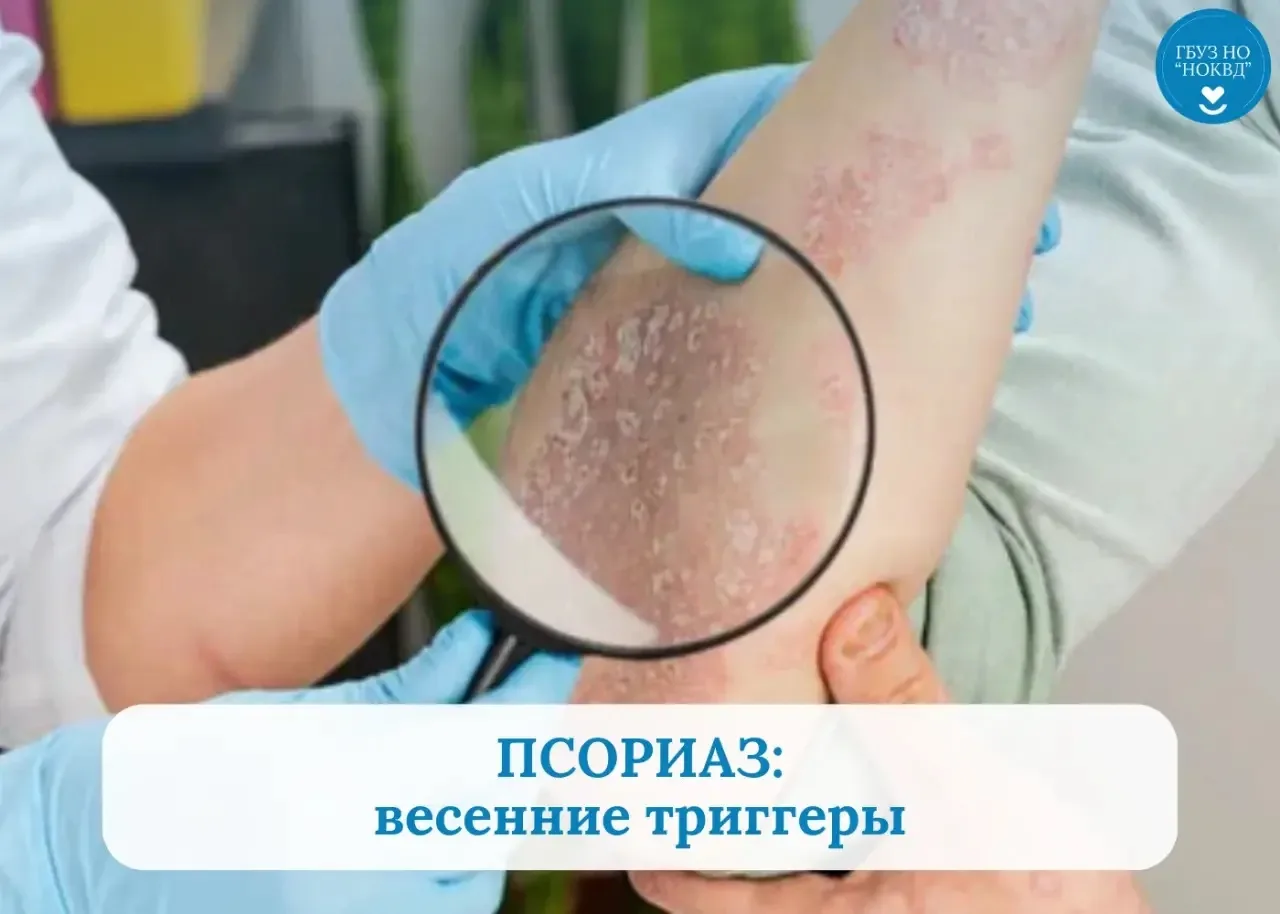 ❓Почему весной псориаз то улучшается, то ухудшается?