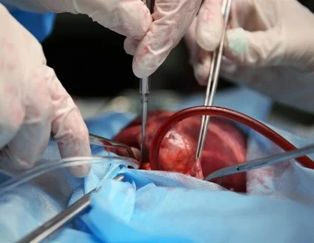 🔬 Внутривенное железо перед операцией на сердце снизило потребность в переливании крови
