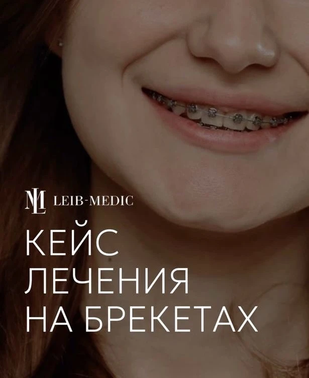 За ортодонтическим лечением всегда стоит не только красивая улыбка, но и самое главное-...