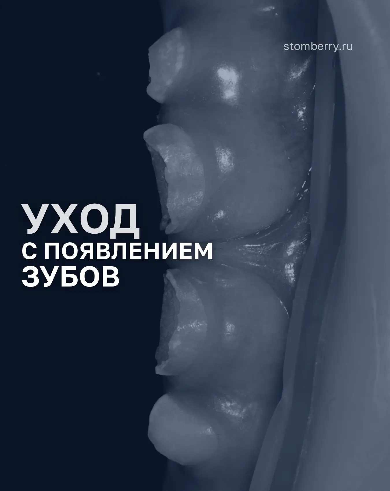 Одна из самых неприятных ошибок в детской стоматологии - не ухаживать за появившимися п...