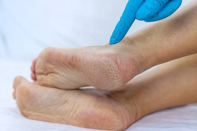 🦶 Почему кожа на ногах становится сухой?