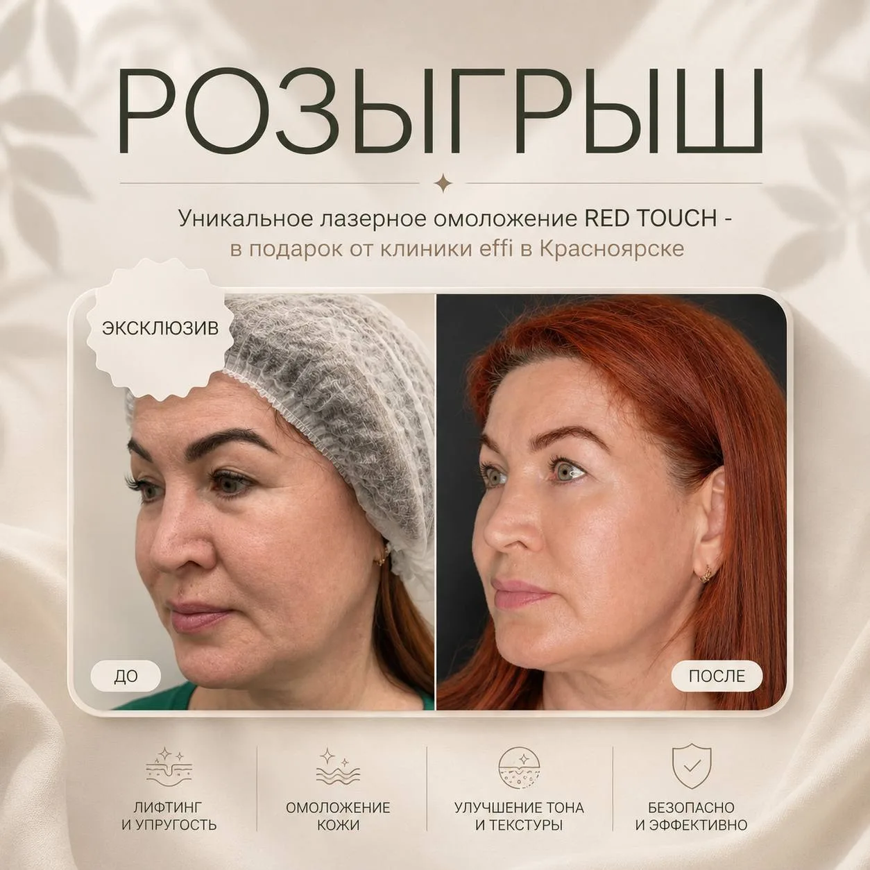 Красноярск, в честь начала осени клиника effi разыгрывает процедуру лазерного омоложени...
