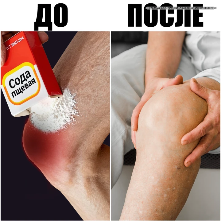 Почему об этом не говорят в поликлинике?

Всего 1 раз в день и суставы как новые.
Хватит терпеть, бо