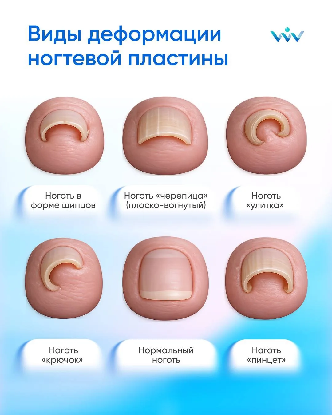 Формы ногтей, которые могут говорить о проблеме 👣