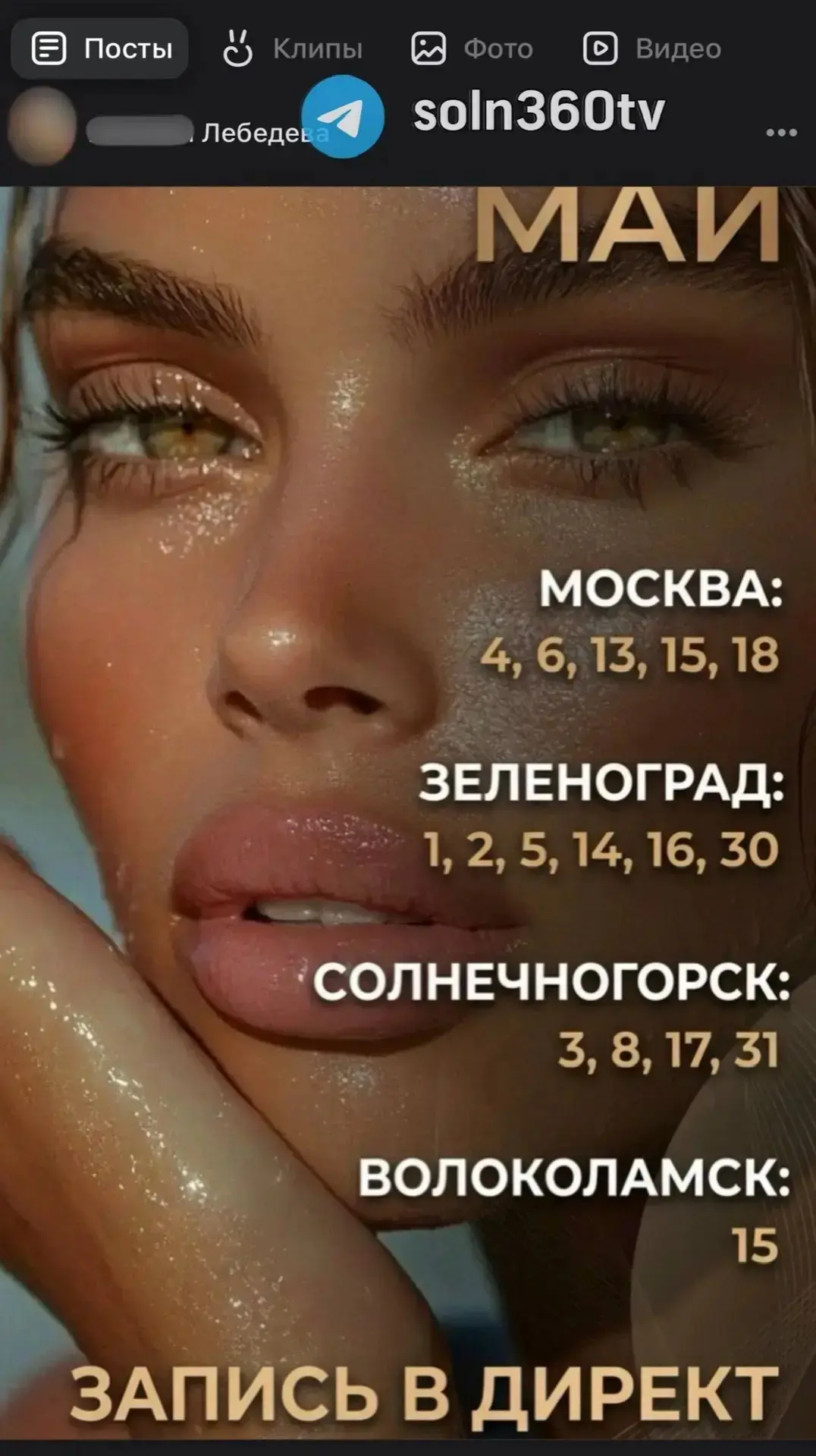В кабинете косметолога в Солнечногорске произошло нападение на съёмочную группу телекан...
