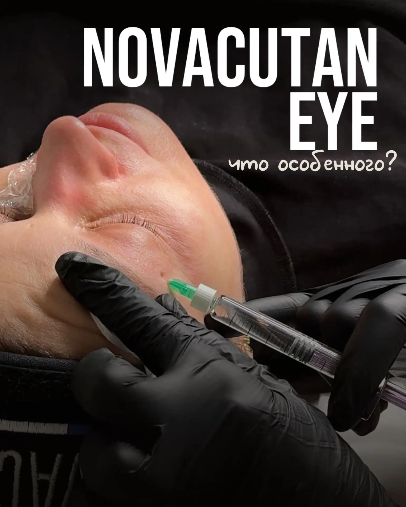 Пептид с ботулоподобным эффектом в новой линейке от Novacutan. 

Novacutan Eye—4 решения в одном пре