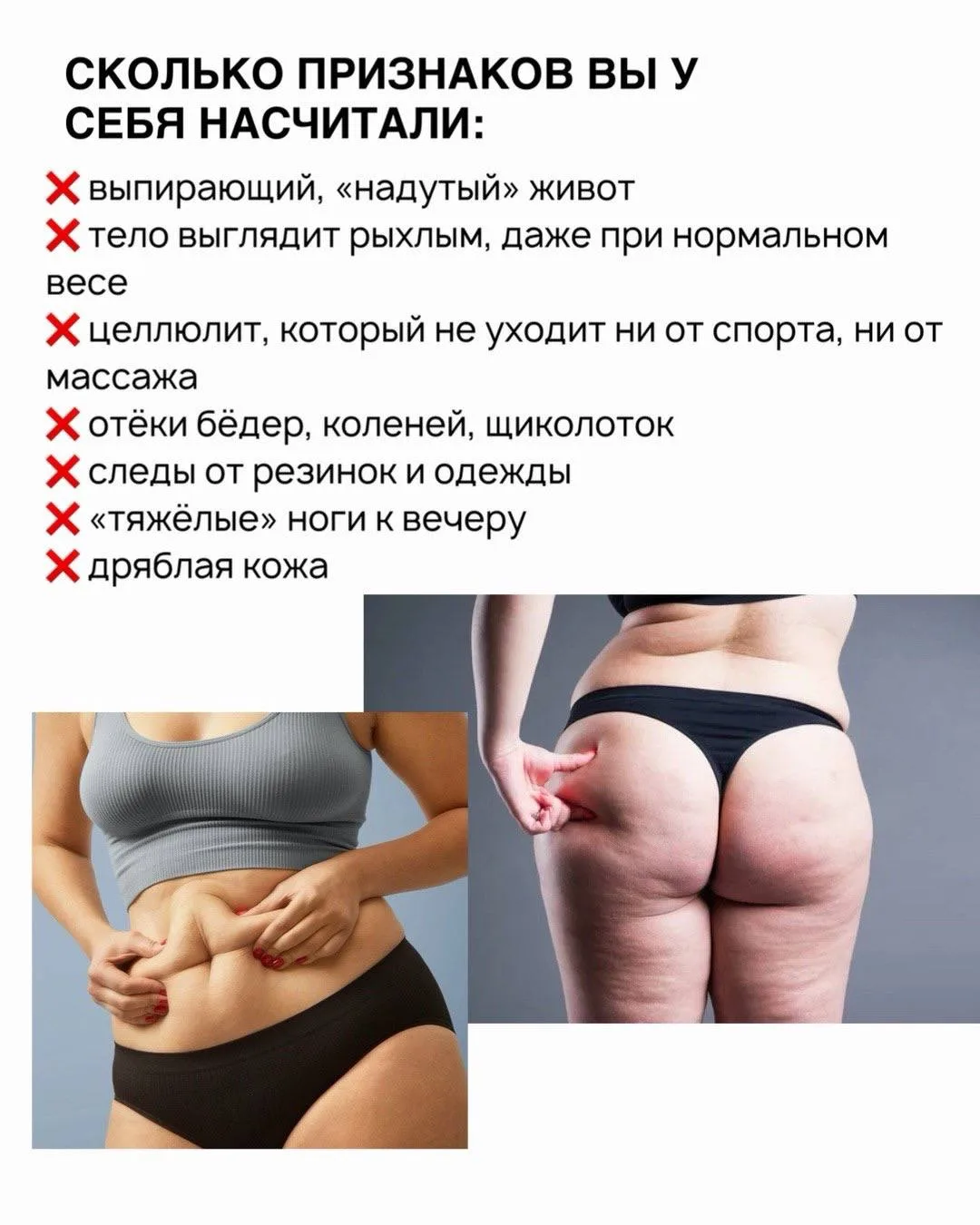Если вес и отёки не уходят — причина глубже.

Даже при дефиците калорий и тренировках:
• живот может