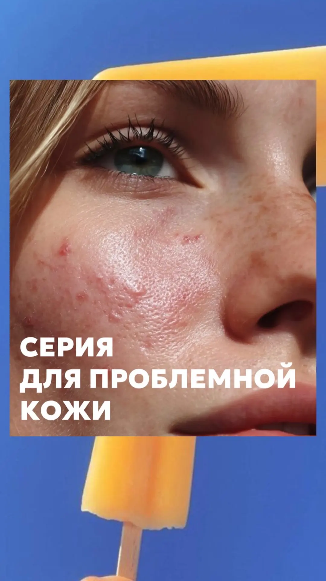 Кожа «взбунтовалась»? У нас есть решение 🔥