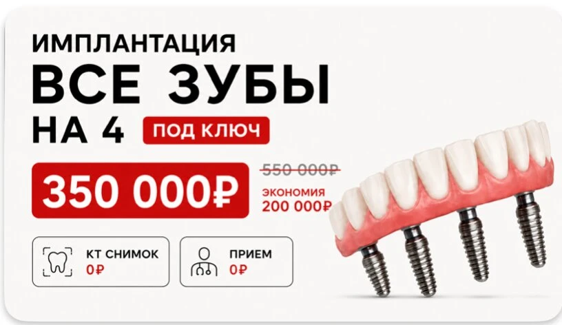 Все зубы на 4 имплантах — выгода 200 000 ₽
