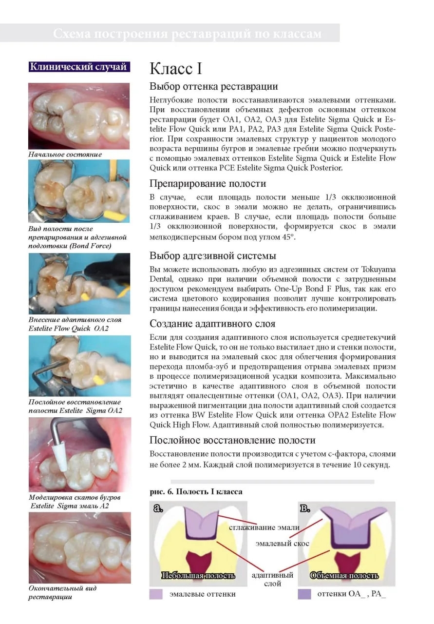 ✨️Схема построения реставрации по 1,2,3,4,5 классу✍🏻