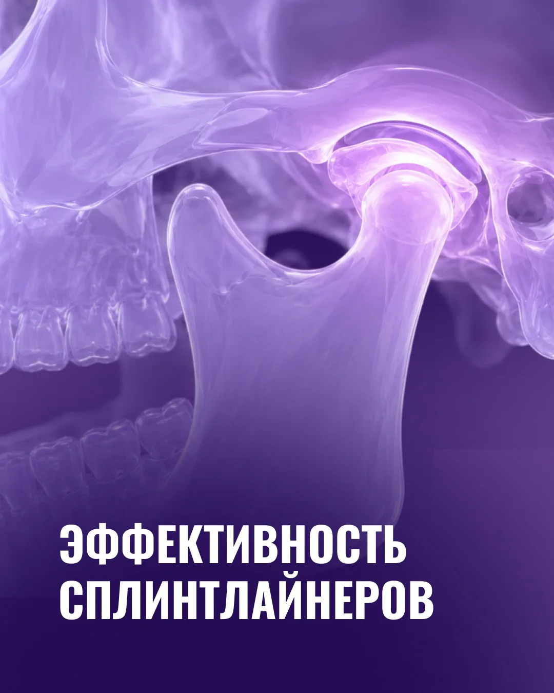 🦷 Сплинтлайнеры — это элайнеры с эффектом репозиционной шины, которые помогают не толь...