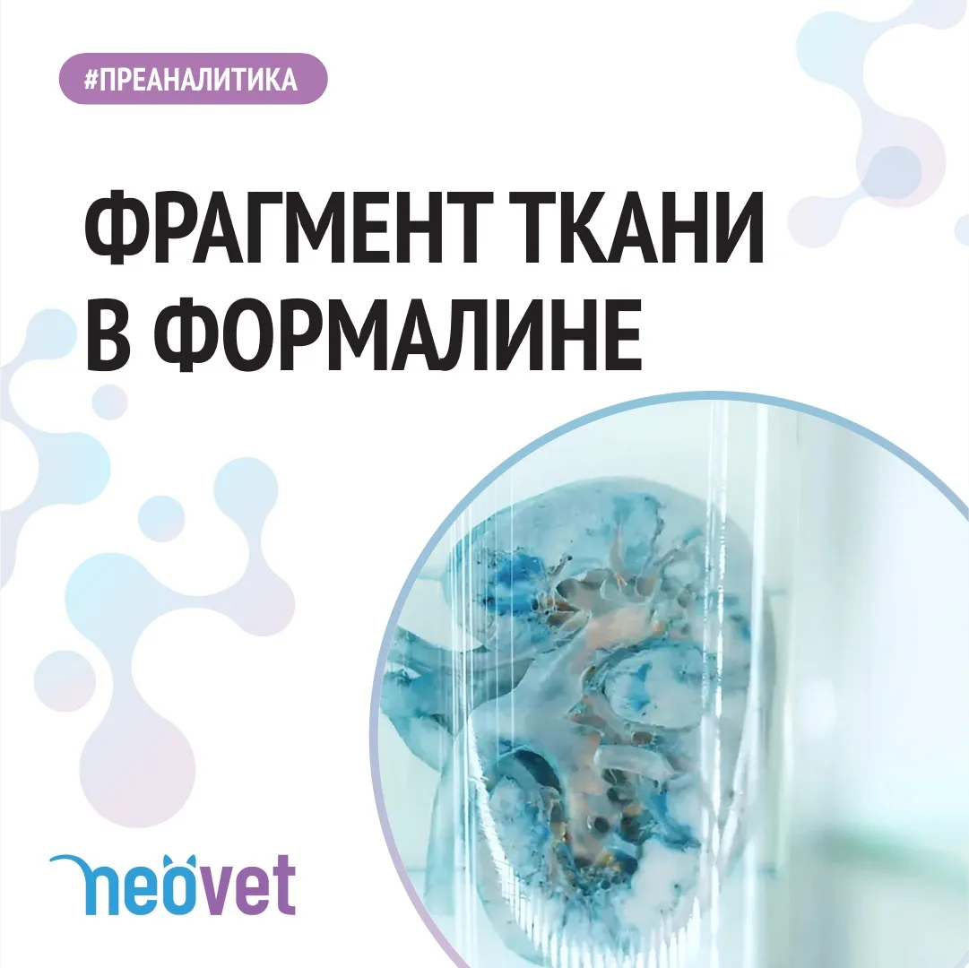 #преаналитика