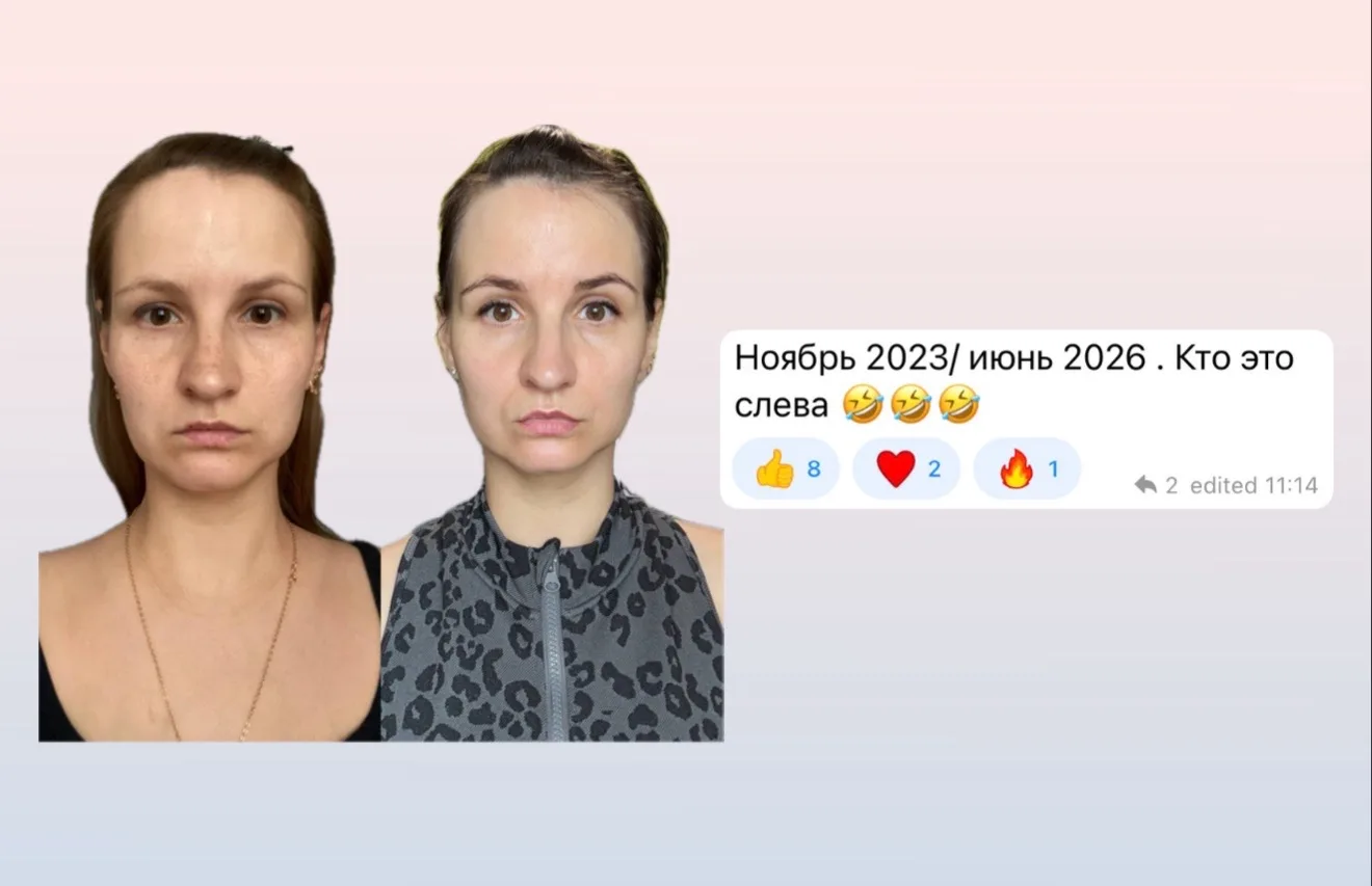 С нами за 3 года не стареют, а молодеют 🪄